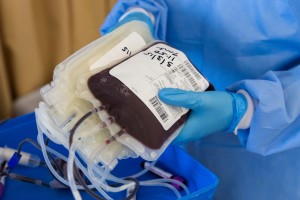 Osocze ozdrowieńców COVID-19: kto i jak może oddać krew?