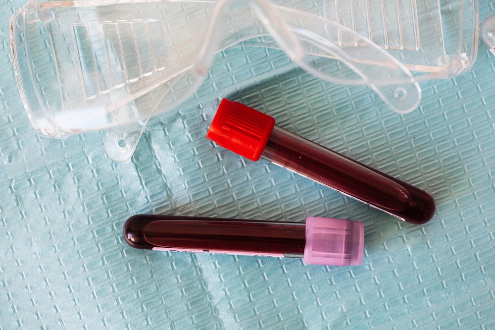 Jak przygotować się do badania krwi?